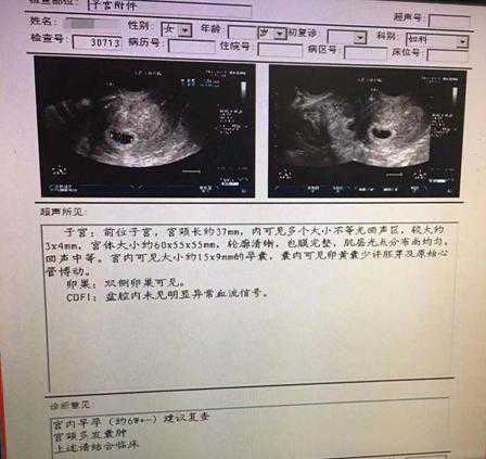 北京医大二院生殖中心_宫外孕切除一侧输卵管 坚持不放弃奇迹诞生